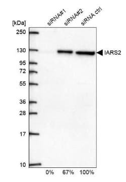 IARS2 Antibody, Novus Biologicals 25 &mu;L; Unlabeled:Antibodies, Polyclonal
